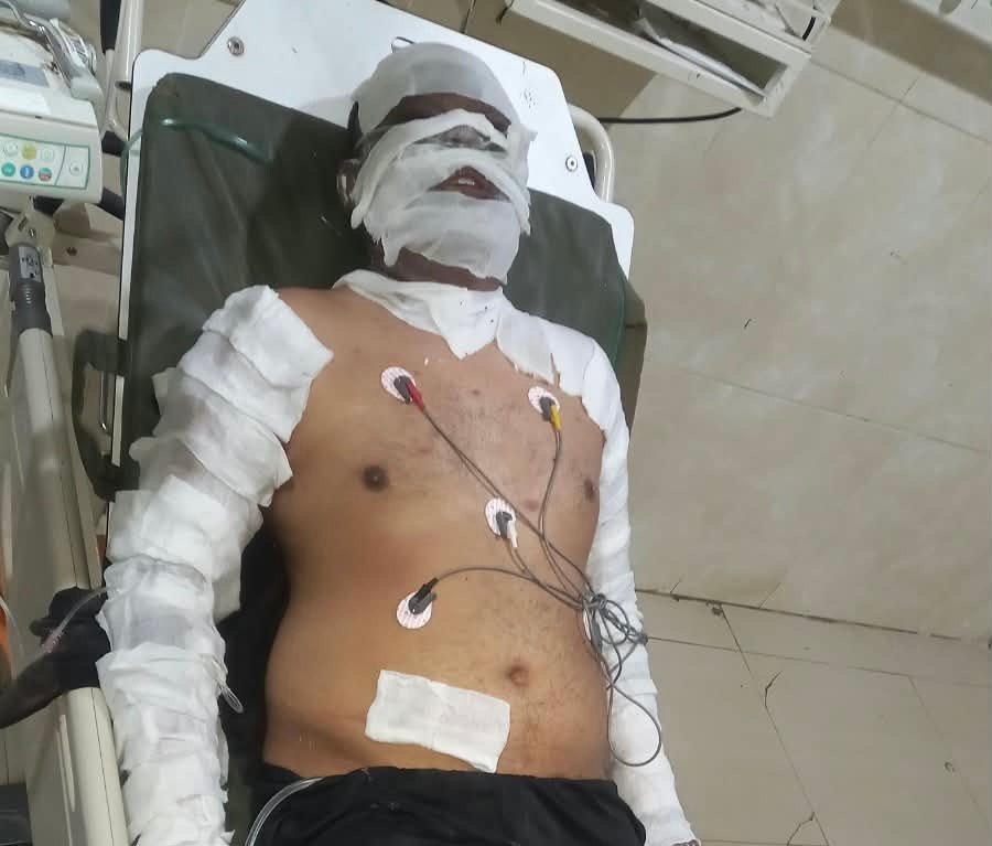 Enam Korban Ledakan Dapur Mall Jamtos, Kasus Dilimpahkan ke Polresta Jambi