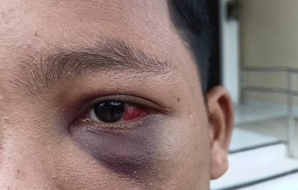 Aniaya Siswa, Oknum Guru Pesantren Dilaporkan ke Polda Jambi